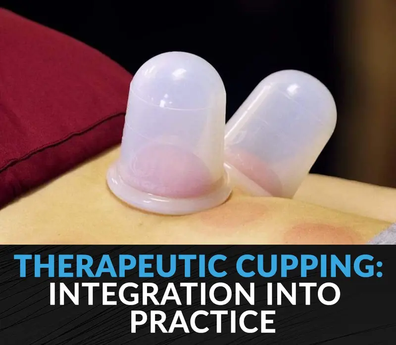 Clinical Corner: Evidence-Based Therapeutic Cupping For Clinical Integration 1